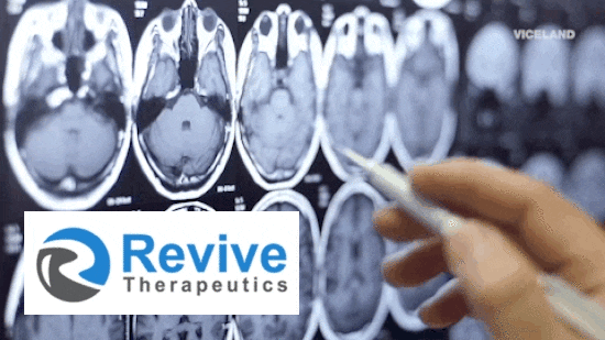 Revive Therapeutics’ (RVV.C) product pipeline is flowing freakishly fast